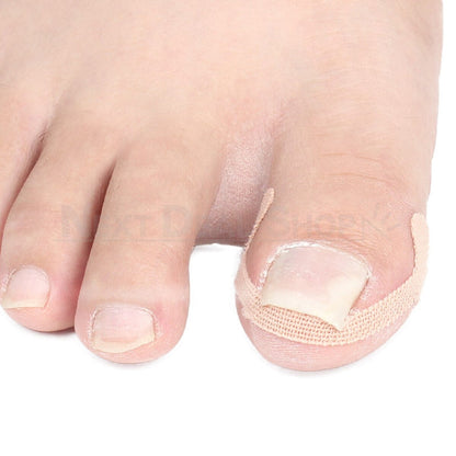 20 Pcs- Ingrown Nail Treatment Sticker