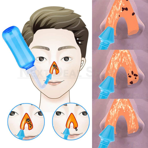 Sinus Rinse Bottle (300ml) – nextdealshop.co.uk